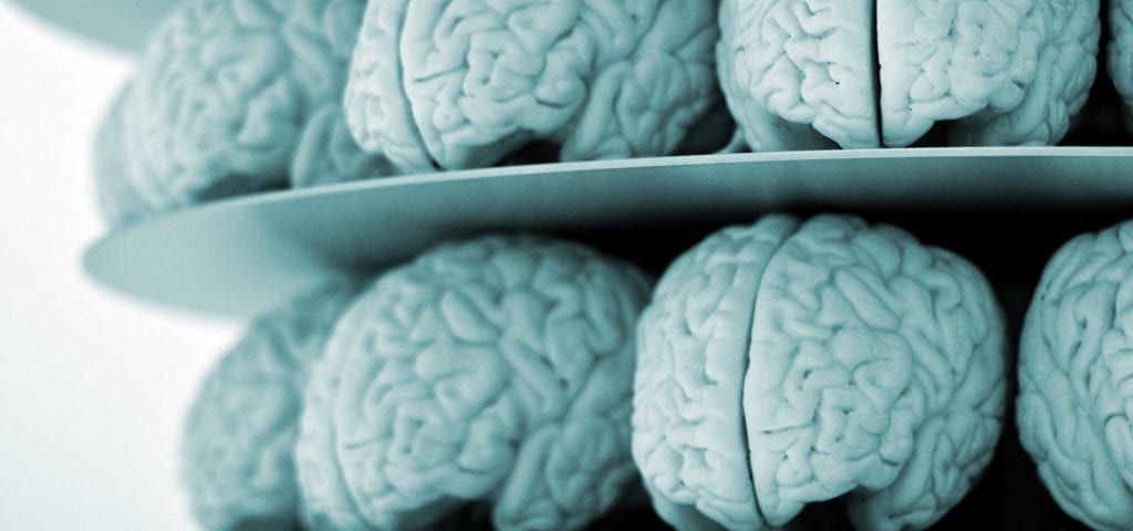 A shelf stacked with medical models of the human brain.